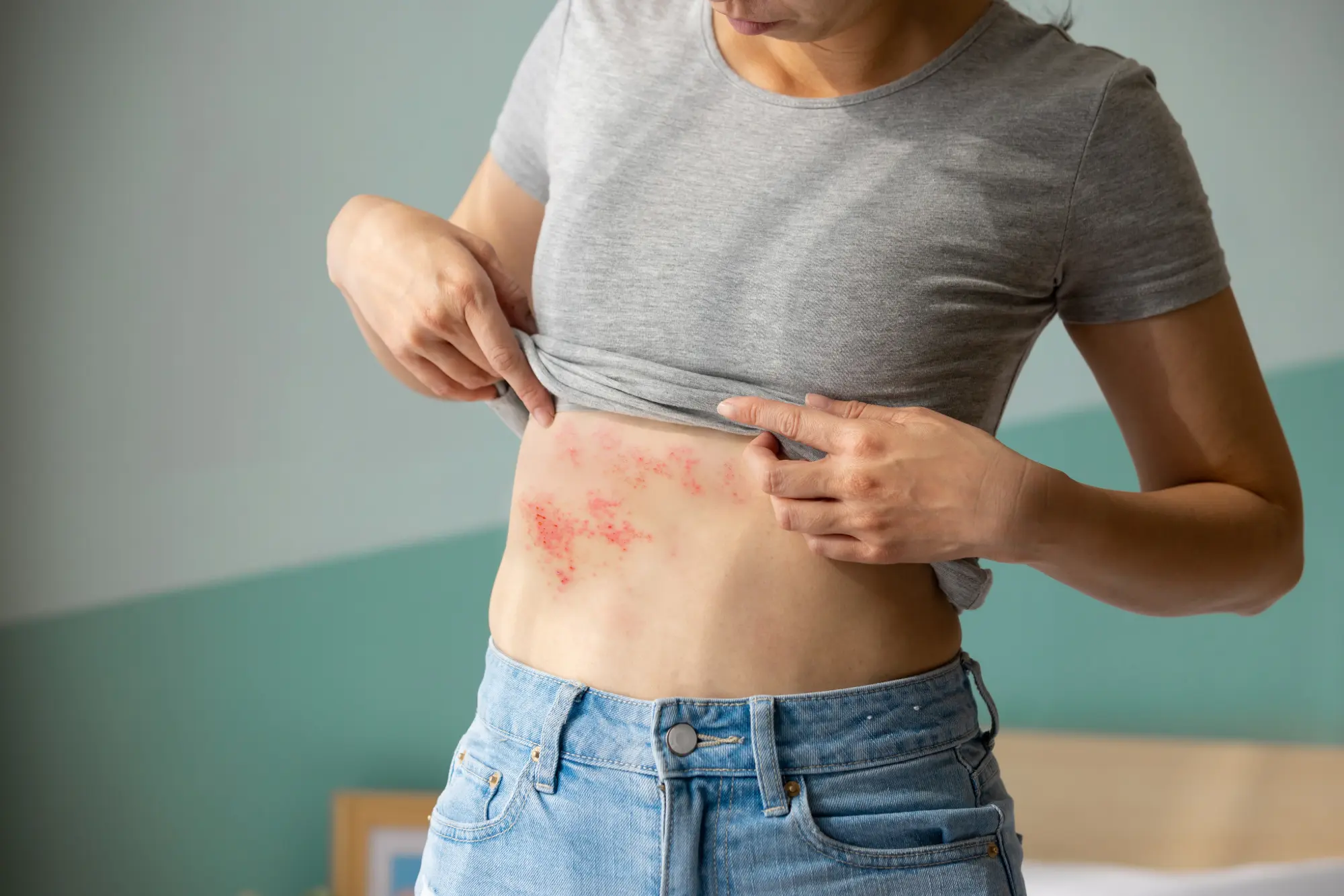 Biltmore Dermatology client with a skin infection